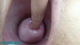 Intense Stimulation Of Cervix With Nettles And Rod Flowers